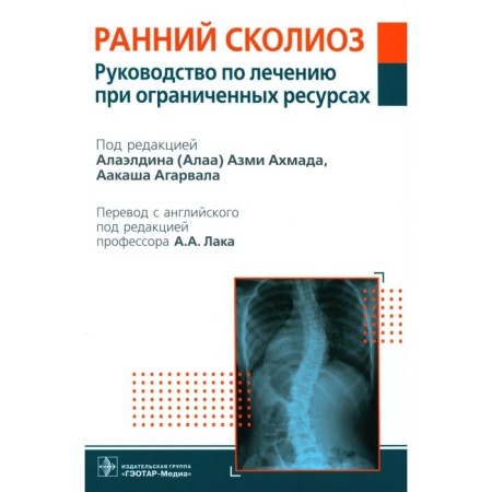 Early scoliosis. Guide for treatment with limited resources. Ed. Akhmada A.A., Agarval A.