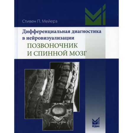 Differential diagnosis in neuroimaging. Spine and spinal cord. Meyers S.P.