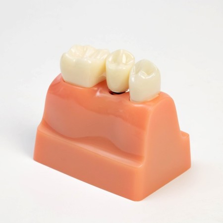 Mett "tooth structure" 9*6*9cm-3