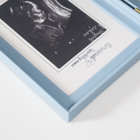 Photo frame plastic 8x12 cm "Our baby" Blue with a frame for ultrasound 2x36.5x22.7 cm-3