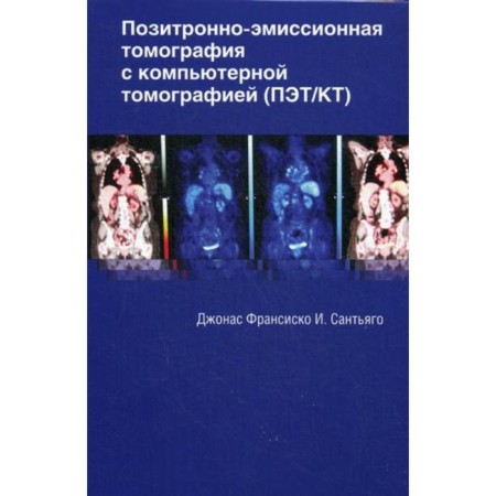 Positron emission tomography with computed tomography (PET/CT). Jonas F.I. S.
