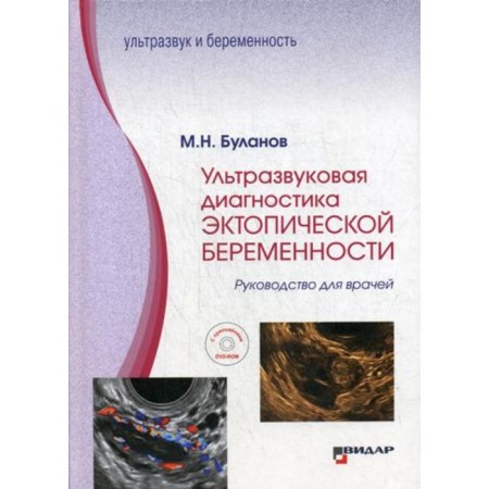 Ultrasound diagnosis of ectopic pregnancy. Bulanov M.N.