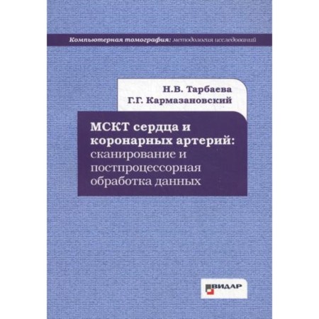 MSCT hearts and coronary arteries: scanning and post -processor data processing. Tarbaeva N.V., Karmazanovsky G.G.