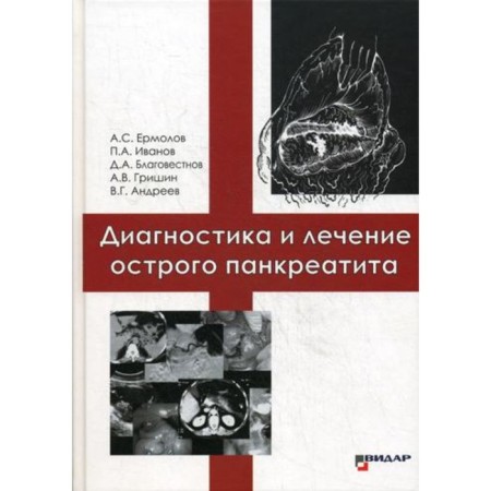 Диагностика и лечение острого панкреатита. Ермолов А.С.