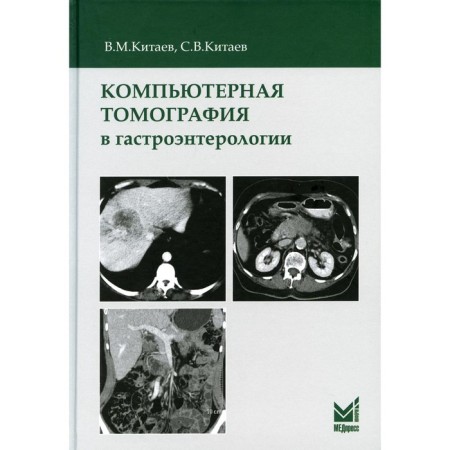 Computed tomography in gastroenterology. 2nd edition. Kitaev V.M., Kitaev S.V.