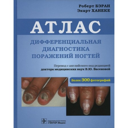 Differential diagnosis of nail lesions. Baran R., Haneke E.