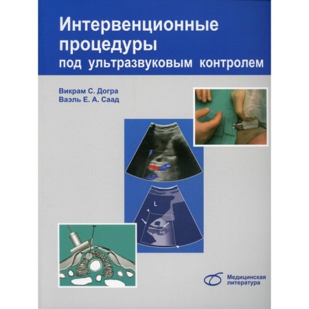 Intervention procedures under ultrasound control. Dogra V.S., Saad V.E.A.