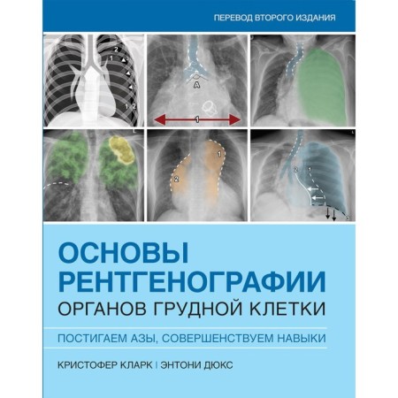 Fundamentals of X -ray of the chest organs. Clark K., Duks E.