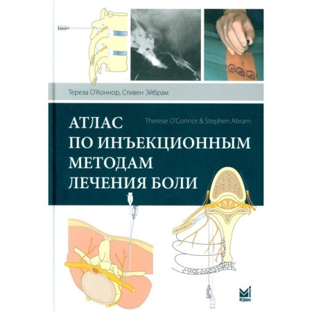 Atlas according to injection methods of treating pain. 2nd edition. O’Connor T., Aibram S.