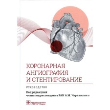 Coronary angiography and stenting