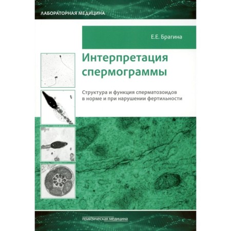 Interpretation of spermograms. The structure and function of sperm is normal and in case of violation of fertility. Bragin E.E.