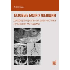 Тазовые боли у женщин. Дифференцианальная диагностика лучевыми методами. Холин А.В.