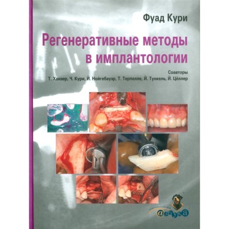 Regenerative methods in implantology. KURY F.