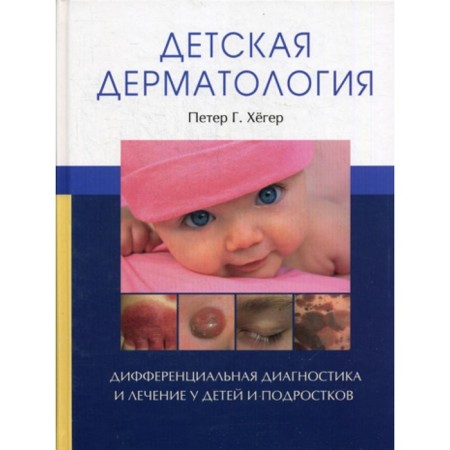 Children's dermatology. Heger P.G.