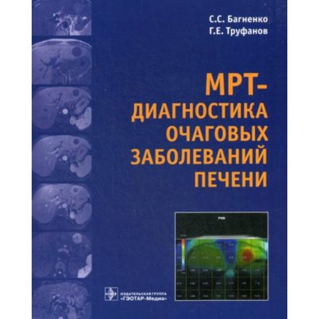 МРТ-диагностика очаговых заболеваний печени. Багненко С.С., Труфанов Г.Е.