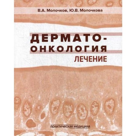 Dermatomoncology. Treatment. Molochkov V.A., Molochkova Yu.V.