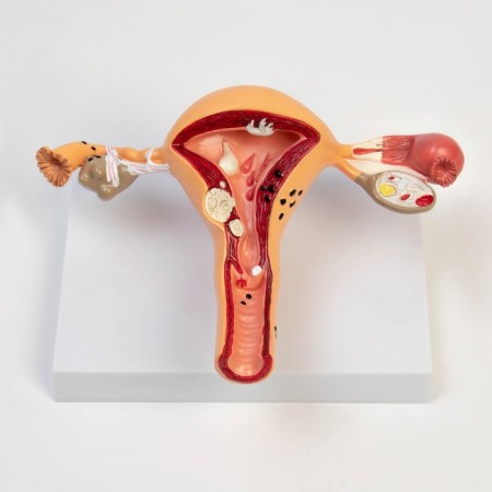 Matcage "Organs of the uterus, pathology" 24*12*20cm-2