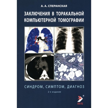 Conclusion in thoracic computed tomography. Symptom, syndrome, diagnosis. 2nd edition. Speranskaya A.A.