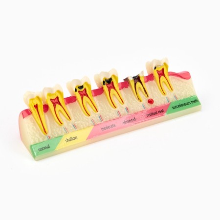Matcage "Dental disease" in the context of 14*5cm