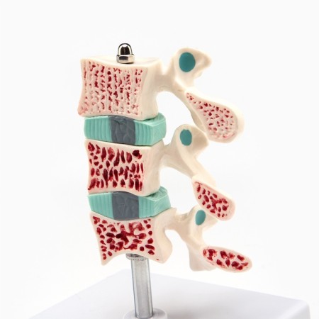 Matcage "spine in the context" 8*7cm-3
