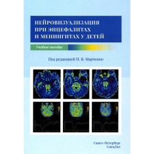 Neurousualization for encephalitis and meningitis in children. Marchenko N.V., Skripchenko E.Yu.