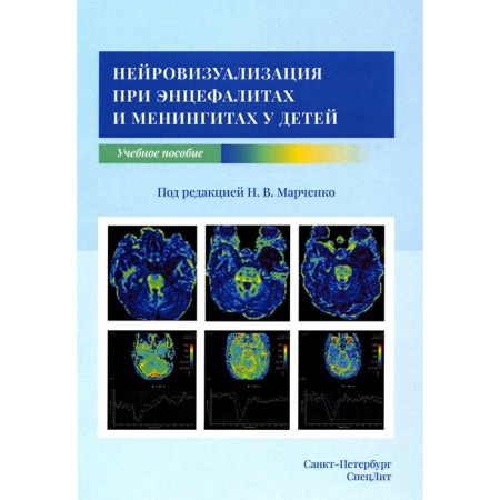 Neurousualization for encephalitis and meningitis in children. Marchenko N.V., Skripchenko E.Yu.