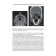 Otorhinolaryngology. under. Ed. Karpishche