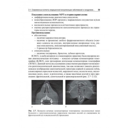 Otorhinolaryngology. under. Ed. Karpishche-9