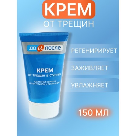 Крем для ног "До и После" от трещин в ступнях, 150 мл-4