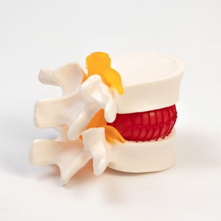 Lock "Intervertebral disc" 11*10*8cm-3