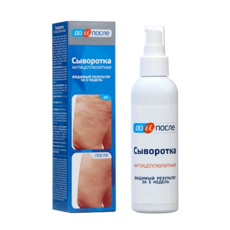 Serum "before and after" anti -cellulite, 130 ml