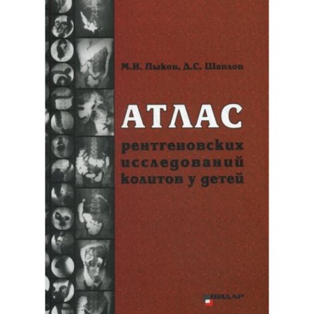 Atlas of X -ray studies of colitis in children. Pykov M.I.