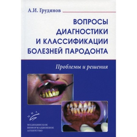 Issues of diagnosis and classification of periodontal diseases. Problems and solutions. Grudyanov A.I.