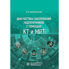 Diagnosis of adrenal diseases using CT and MRI. Arablinsky A.V.