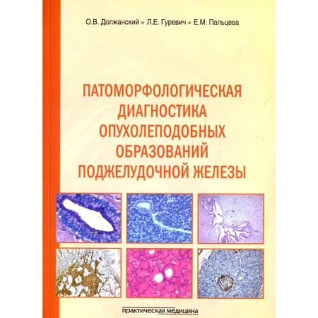 Pathomorphological diagnosis of tumor -like pancreatic formations. Dolzhansky O.V., Gurevich L.E.