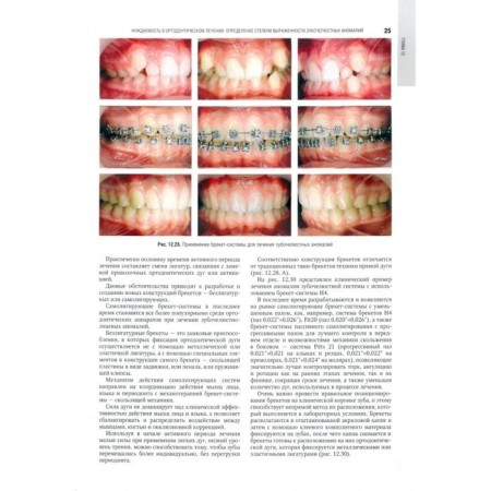 Orthodontics. Volume 2. Treatment of dentistal anomalies-2
