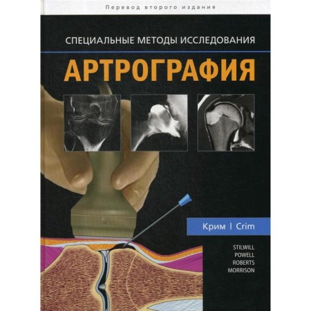 Arthrography. Special research methods. CRIM J.R.