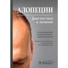 Alopecia. Diagnostics and treatment. Edited by Bohanna