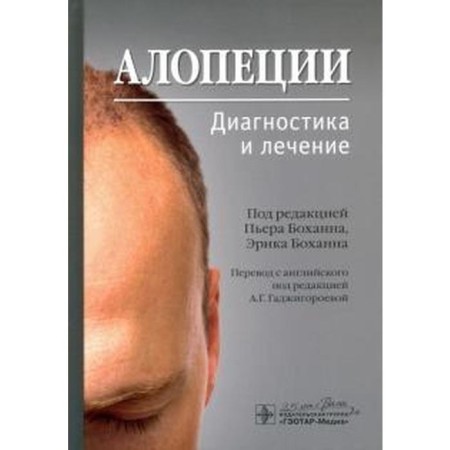 Alopecia. Diagnostics and treatment. Edited by Bohanna