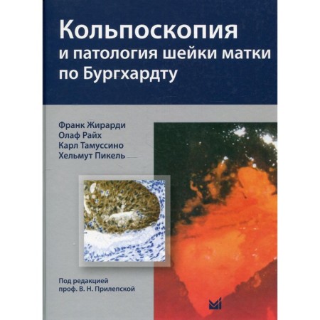 Kolposcopy and pathology of the cervix according to Burghardt. Girardi F.