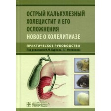 Acute calculous cholecystitis and its complications. New about Hollytiaz. Practical leadership
