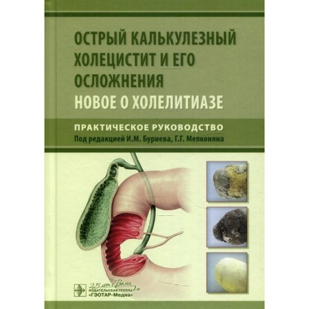Acute calculous cholecystitis and its complications. New about Hollytiaz. Practical leadership
