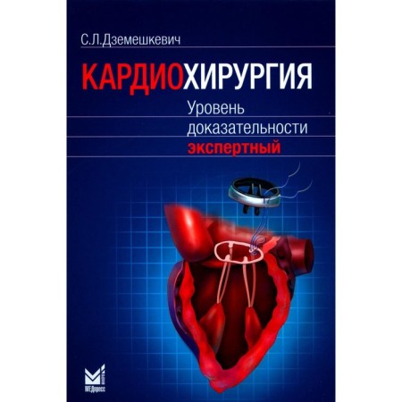 Cardiac surgery. The level of evidence: Expert. Dzemeshkevich S.L.