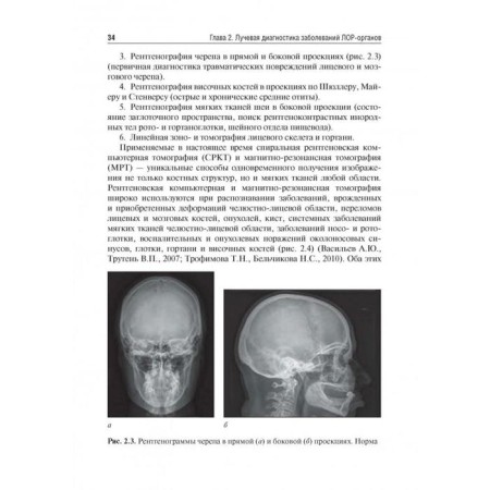 Otorhinolaryngology. under. Ed. Karpishche-4