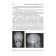 Otorhinolaryngology. under. Ed. Karpishche