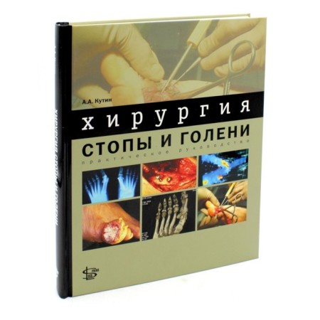 Surgery of the foot and lower leg. Practical leadership. Kutin A.A.