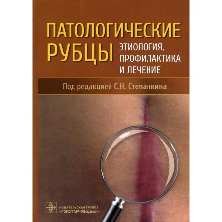 Pathological scars. Etiology, prevention and treatment