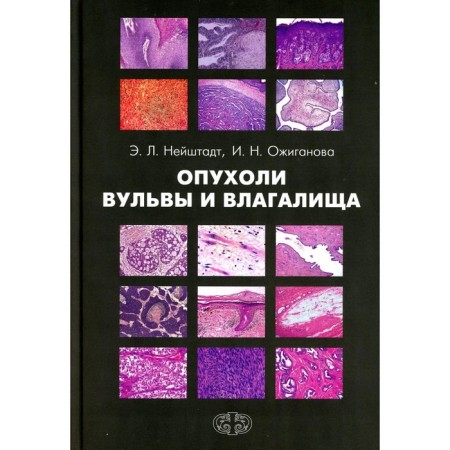 Tumors of vulva and vagina. Neushtadt E.L., Olygova I.N.