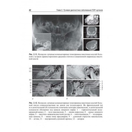 Otorhinolaryngology. under. Ed. Karpishche-12