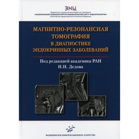 Magnetic resonance imaging in the diagnosis of endocrine diseases